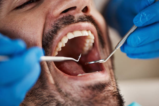 Best Periodontal (Gum) Disease Treatment  in Huntertown, IN
